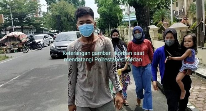  Mahasiswa Asal Pasar 9 Tembung Kondisi Berdarah Datang ke SPKT Polrestabes Medan