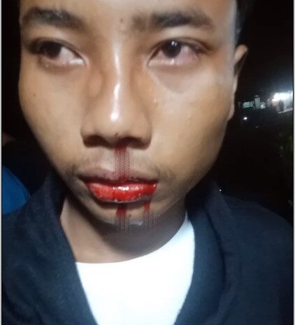 Sekelompok Pemuda Aniaya Seorang Pelajar di Depan SPBU Nagori Perlanan