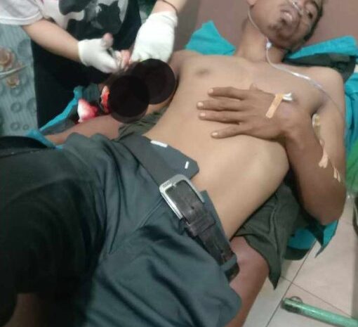 Tangan Jupri Nyaris Putus Ditebas, Begal Sadis Bercelurit Ditembak Polres Batubara