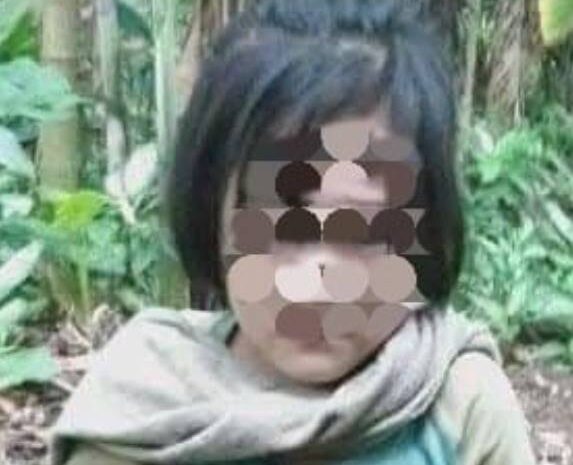  Viral Seorang Anak di Nias Selatan Diduga Disiksa Keluarganya, Kedua Kakinya Patah