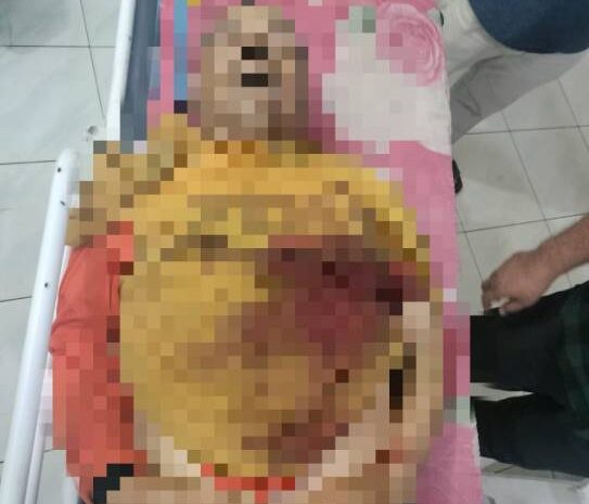  Polres Simalungun Ungkap Kasus Pembunuhan Kakak Kandung Akibat Sengketa Warisan