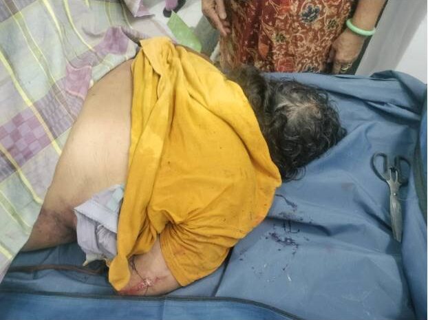  Kecelakaan Maut di Perlintasan KA Simpang Durian Batubara, Korban Terseret Sejauh 200 Meter