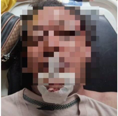  Kasus Kematian Nico Saragih: LBH Medan Minta Polisi Transparan dan Profesional