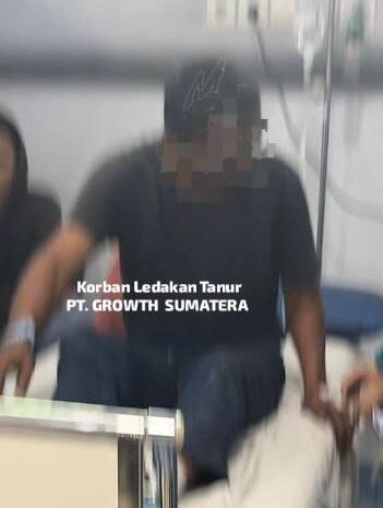  Kurangnya Menekuni K3, Tanur PT. Growth Sumatera Meledak 3 Pekerja Alami Luka Bakar