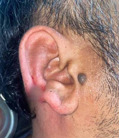  Penanganan Humanis di Dairi, 10 Personel Terluka, Polda Sumut Tegaskan Komitmen Jaga Kamtibmas