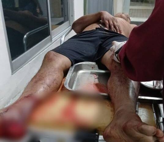  Penculikan dan Penganiayaan Puluhan Pemuda Suruhan GS, Dikabarkan Satu Korban Lagi Masih Diculik dan Disiksa Hingga Jari-Jari Tangan Putus
