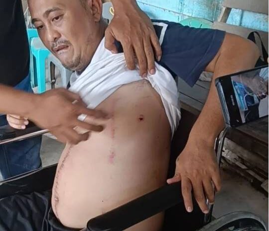  ‘Geng Star’ Tembaki Pengusaha Turunan di Tanjung Morawa, Polda Sumut Didesak Turun Tangan